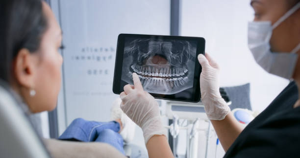 Licensed Dental Implants service in Montebello, CA - Smile Center Dentistry